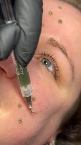 INFLACURE